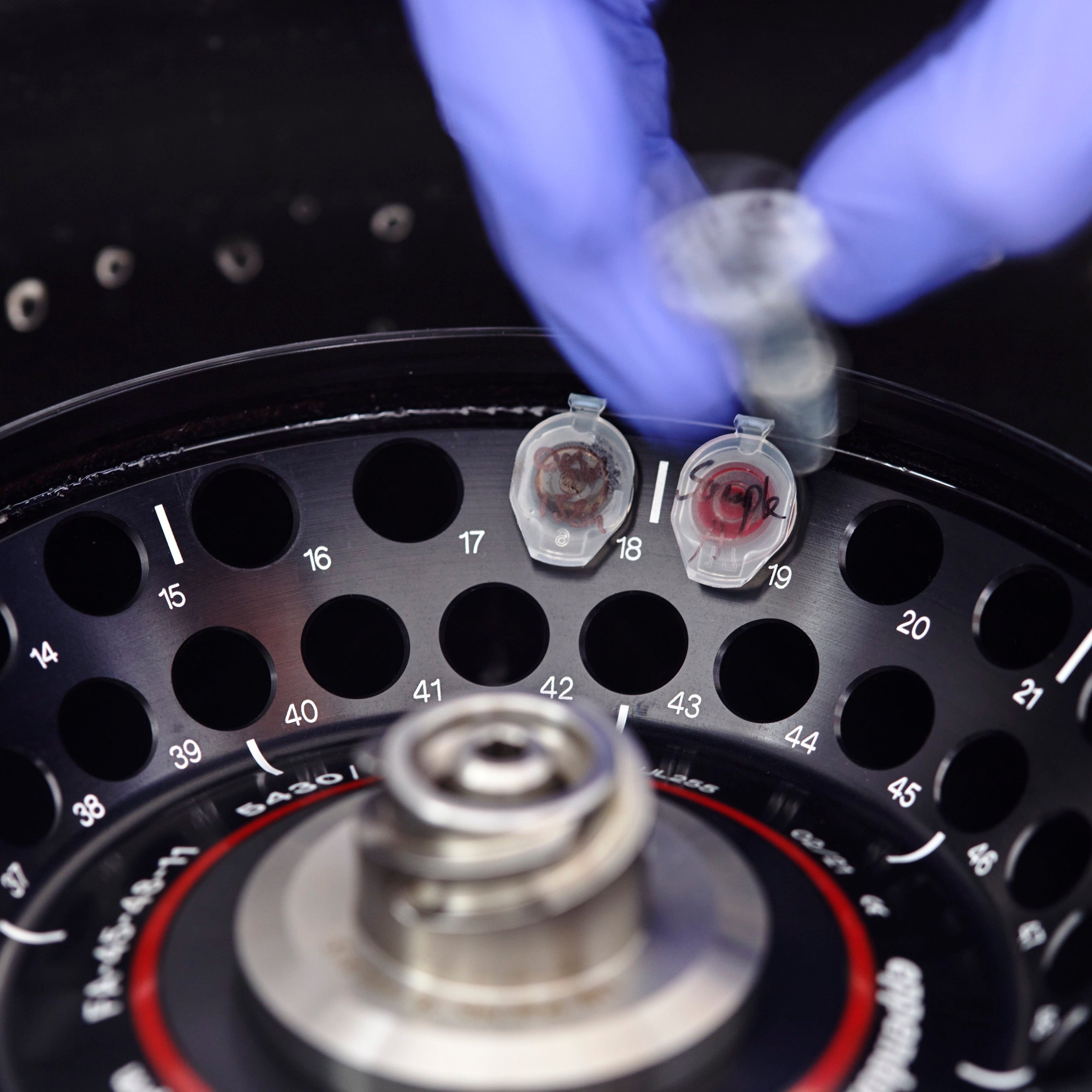 Advanced lab tests at Chenot Palace Weggis
