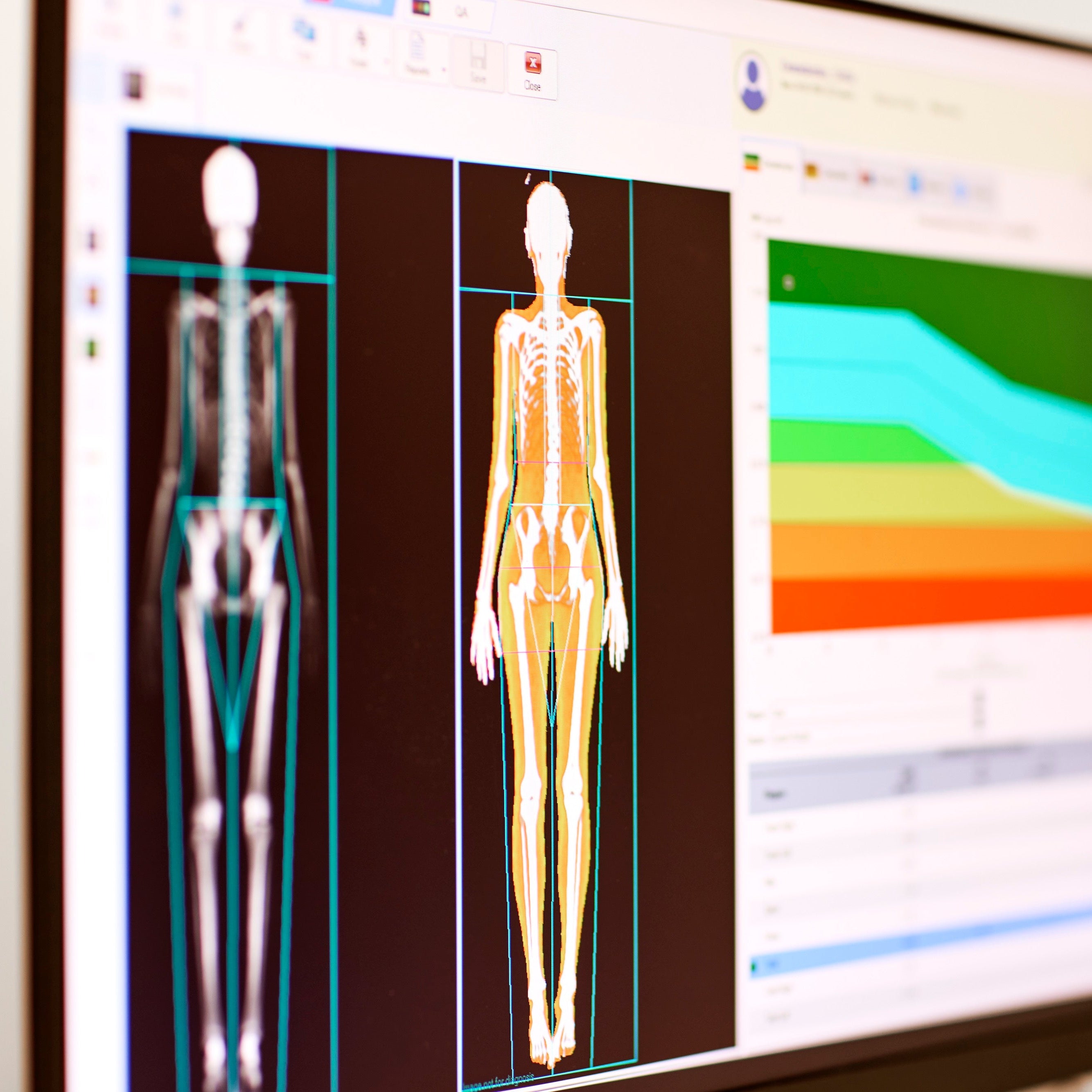 In-depth scan of the body health at Chenot Palace Weggis