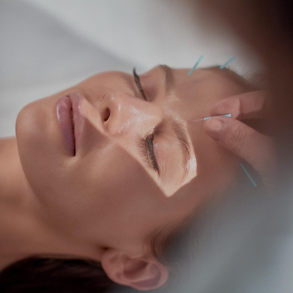 Acupuncture is one of the TCM techniques used at Lefay Lago di Garda in wellness programs. It allows the rebalancing of energy in the meridians